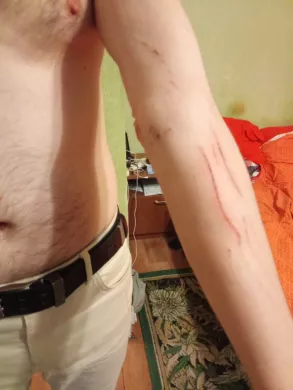1) Следы побоев на теле мужа Надежды Беловой / Фото: Надежда Белова, «Слово защите»