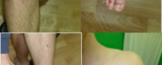 Жалоба на пытки в Нижегородской области дошла до Страсбурга