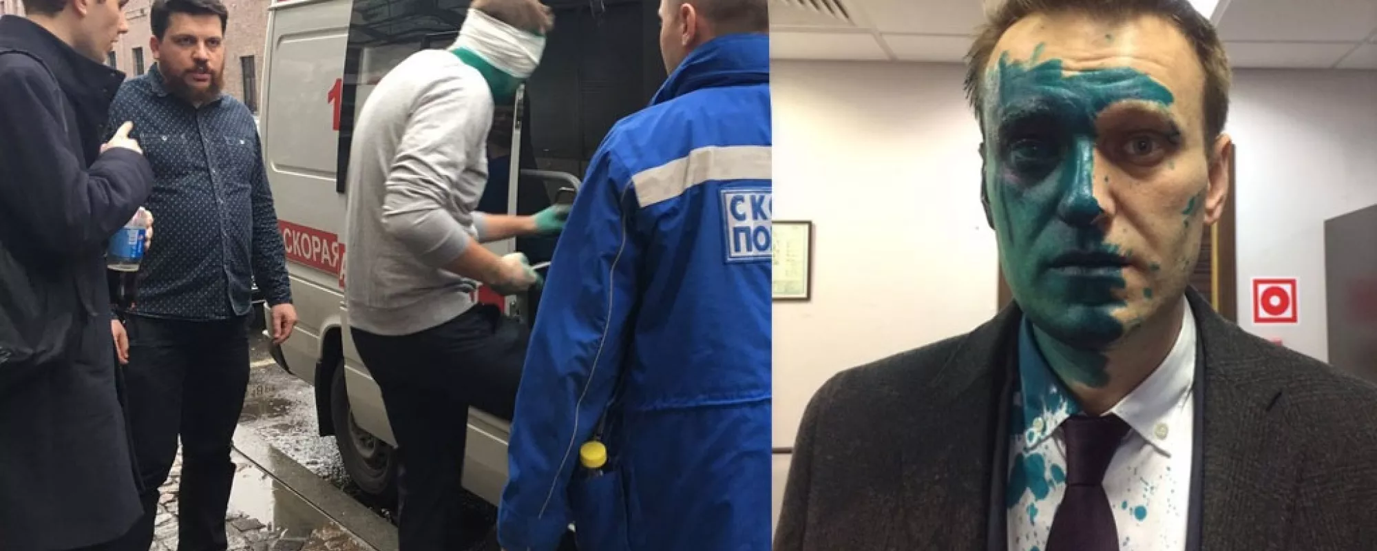 В нападении на Навального могло участвовать четыре человека
