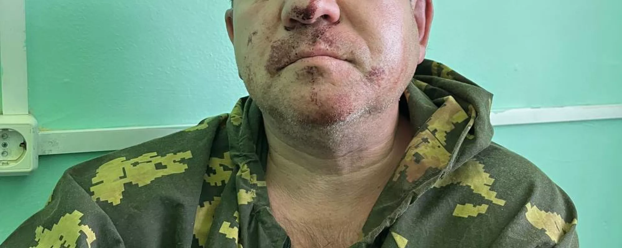 В Нижегородской области напали на члена СПЧ и основателя «Комитета против пыток» Игоря Каляпина