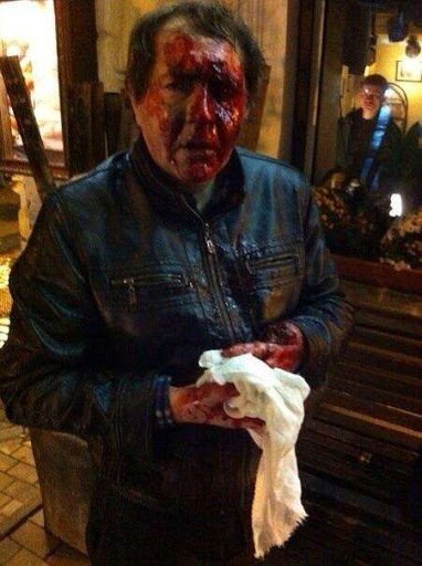 Илья Романов после взрыва пиротехники / Фото: twitter.com/opernn