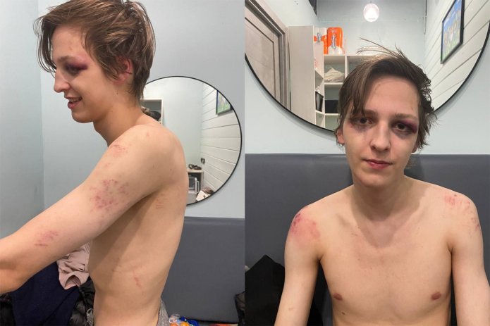 <em>Денис Охрямкин после обыска и насилия со стороны сотрудников ФСБ, ноябрь 2023 года / телеграм-канал «Голос перемен»</em>