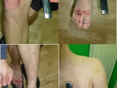      Жалоба на пытки в Нижегородской области дошла до Страсбурга
    