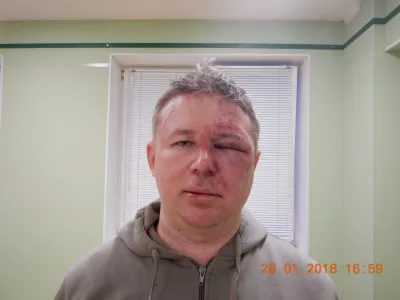  «Методично били по голове, преимущественно ногами» 